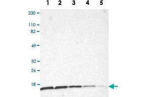Western Blot analysis of Lane 1: RT-4, Lane 2: U-251MG sp, Lane 3: A-431, Lane 4: human liver and Lane 5: human tonsil lysates with RPS20 polyclonal antibody . (RPS20 抗体)
