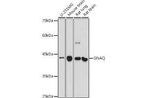 Western blot analysis of extracts of various cell lines, using GNAQ antibody (ABIN7267542) at 1:500 dilution.