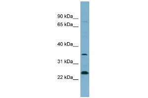 WB Suggested Anti-NOSIP Antibody Titration: 0. (NOSIP 抗体  (N-Term))
