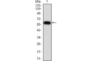 Western Blotting (WB) image for anti-Karyopherin alpha 2 (RAG Cohort 1, Importin alpha 1) (KPNA2) (AA 1-530) antibody (ABIN5921583) (KPNA2 抗体  (AA 1-530))