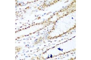 Immunohistochemistry of paraffin-embedded human stomach using HDAC1 antibody. (HDAC1 抗体  (AA 393-482))