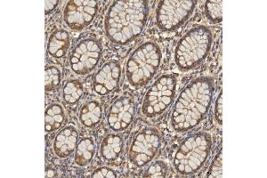 IHC analysis of TST using anti-TST antibody (ABIN7599105). (TST 抗体  (AA 1-220))