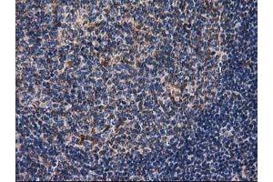 Image no. 15 for anti-Destrin (Actin Depolymerizing Factor) (DSTN) antibody (ABIN1497910) (Destrin 抗体)