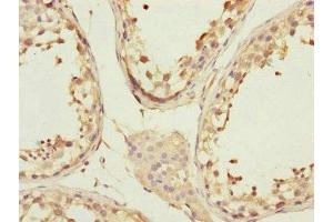 Immunohistochemistry of paraffin-embedded human testis tissue using ABIN7148058 at dilution of 1:100 (CCHCR1 抗体  (AA 483-782))