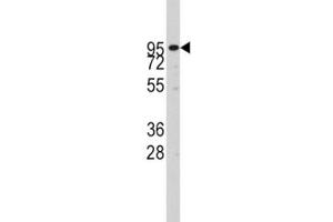 Western blot analysis of ADAM17 antibody and CEM lysate (ADAM17 抗体  (AA 195-224))