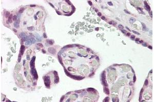 Anti-DLX3 antibody IHC staining of human placenta. (DLX3 抗体  (N-Term))