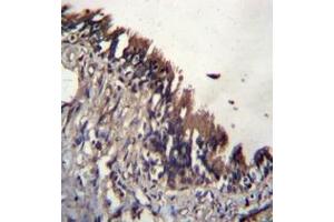 Immunohistochemistry (Paraffin-embedded Sections) (IHC (p)) image for anti-Nudix (Nucleoside Diphosphate Linked Moiety X)-Type Motif 9 (NUDT9) (AA 317-347), (C-Term) antibody (ABIN953786)