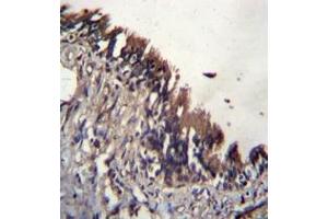 Immunohistochemistry analysis in formalin fixed and paraffin embedded human lung tissue reacted with NUDT9 / NUDT10 (C-term)  Antibody  followed by peroxidase conjugation of the secondary antibody and DAB staining. (NUDT9 抗体  (C-Term))
