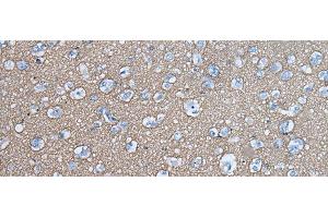 Immunohistochemistry of paraffin-embedded Human brain tissue using SNCB Polyclonal Antibody at dilution of 1:45(x200) (beta Synuclein 抗体)