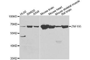 Western blot analysis of extracts of various cell lines, using ZNF195 antibody. (ZNF195 抗体  (AA 1-250))