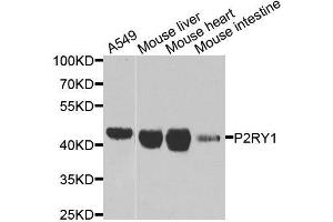 Western blot analysis of extracts of various cell lines, using P2RY1 antibody. (P2RY1 抗体  (AA 274-373))