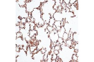 Immunohistochemistry (IHC) image for anti-Vimentin (VIM) (AA 1-200) antibody (ABIN3016292)