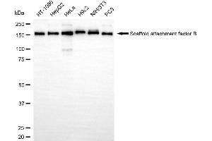 anti-Scaffold Attachment Factor B (SAFB) antibody