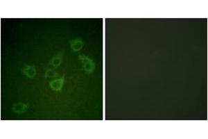 Immunofluorescence analysis of HuvEc cells, using Caspase 6 (Phospho-Ser257) Antibody. (Caspase 6 抗体  (pSer257))