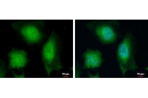 ICC/IF Image Calcipressin 1 antibody detects Calcipressin 1 protein at cytoplasm and nucleus by immunofluorescent analysis. (RCAN1 抗体  (C-Term))