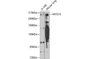 Western blot analysis of extracts of various cell lines, using MYO10 antibody (ABIN6128320, ABIN6144272, ABIN6144275 and ABIN6224500) at 1:1000 dilution. (Myosin X 抗体  (AA 845-944))