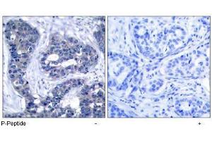 Image no. 1 for anti-Insulin Receptor Substrate 1 (IRS1) (pSer639) antibody (ABIN196981) (IRS1 抗体  (pSer639))