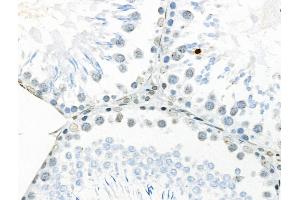 ABIN7093232 and ABIN7097244 at 1/100 staining Rat testis tissue by IHC-P.