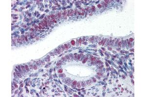 Anti-HSF1 antibody IHC of human uterus. (HSF1 抗体)