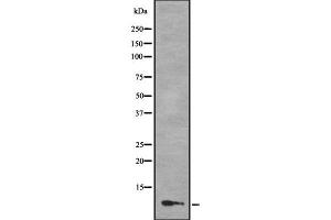 Western blot analysis of MLLT11 using COLO205 whole cell lysates (MLLT11 抗体  (N-Term))