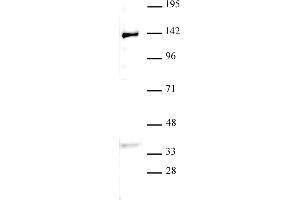 JMJD2B / KDM4B antibody (pAb) tested by Western blot. (KDM4B 抗体  (C-Term))
