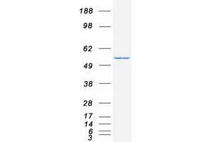 Western Blotting (WB) image for Cytochrome P450, Family 2, Subfamily C, Polypeptide 9 (CYP2C9) protein (Myc-DYKDDDDK Tag) (ABIN2712767)