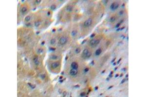 IHC-P analysis of Liver tissue, with DAB staining. (Clusterin 抗体  (AA 228-449))