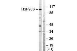 Western blot analysis of extracts from Hela cells treated with TNF-α (20 ng/mL, 30 min), using HSP90B (Ab-254) antibody.
