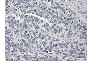 Immunohistochemistry (IHC) image for anti-Protein Phosphatase 5, Catalytic Subunit (PPP5C) antibody (ABIN2729511)