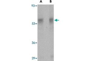Western blot analysis of PLXDC1 in rat liver tissue lysate with PLXDC1 polyclonal antibody  at (A) 0.