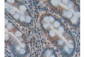 IHC-P analysis of Human Stomach Tissue, with DAB staining. (COL3A1 抗体  (AA 1059-1466))