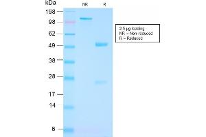 SDS-PAGE Analysis Purified FOLH1 Rabbit Recombinant Monoclonal Antibody (FOLH1/3149R). (Recombinant PSMA 抗体  (AA 232-433))
