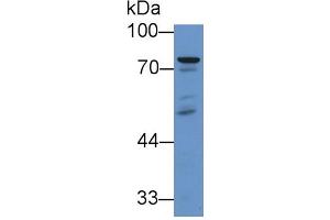 Rabbit Capture antibody from the kit in WB with Positive Control: Sample Human liver lysate.