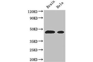 Western Blot Positive WB detected in: Mouse brain tissue, Hela whole cell lysate All lanes: ASS1 antibody at 3 μg/mL Secondary Goat polyclonal to rabbit IgG at 1/50000 dilution Predicted band size: 47 kDa Observed band size: 47 kDa (ASS1 抗体  (AA 168-222))