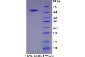SDS-PAGE analysis of Pig ACE Protein. (Angiotensin I Converting Enzyme 1 蛋白)