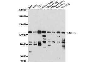 Western blot analysis of extracts of various cell lines, using UNC5B antibody (ABIN6291227) at 1:1000 dilution. (UNC5B 抗体)
