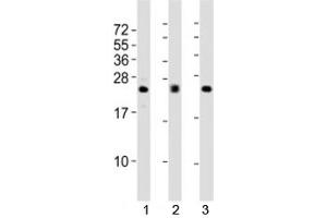 Western blot testing of FGF2 antibody at 1:2000 dilution (FGF2 抗体)