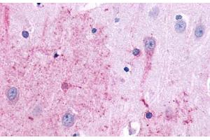 Anti-TACR3 antibody  ABIN1049390 IHC staining of human brain, neurons and glia. (TACR3 抗体  (N-Term))