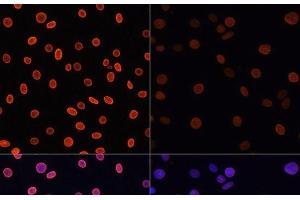 Immunofluorescence analysis of C6 cells using Acetyl-Histone H4-K91 Polyclonal Antibody at dilution of 1:100. (Histone H4 抗体  (acLys91))