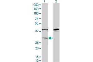 Western Blot analysis of SULT1A1 expression in transfected 293T cell line by SULT1A1 monoclonal antibody (M01A), clone 1F8. (SULT1A1 抗体  (AA 1-295))