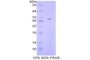 SDS-PAGE analysis of Human STAT4 Protein. (STAT4 蛋白)