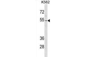Western Blotting (WB) image for anti-Zinc Finger Protein 736 (ZNF736) antibody (ABIN3000781) (ZNF736 抗体)