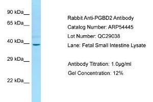 Western Blotting (WB) image for anti-PiggyBac Transposable Element Derived 2 (PGBD2) (Middle Region) antibody (ABIN2785716) (PGBD2 抗体  (Middle Region))