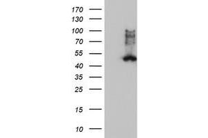 Western Blotting (WB) image for anti-Farnesyl-Diphosphate Farnesyltransferase 1 (FDFT1) antibody (ABIN1498243) (FDFT1 抗体)
