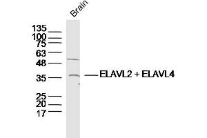 anti-Elavl2 + Elavl4 (AA 31-110) antibody