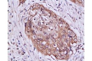 Immunohistochemistry (Paraffin-embedded Sections) (IHC (p)) image for anti-Signal Transducer and Activator of Transcription 3 (Acute-Phase Response Factor) (STAT3) (AA 233-330) antibody (ABIN738261)
