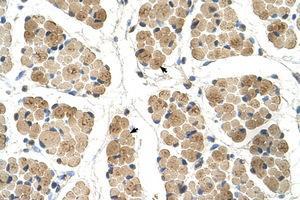 Image no. 1 for anti-Kelch-Like 31 (KLHL31) (AA 501-550) antibody (ABIN6736672) (KLHL31 抗体  (AA 501-550))