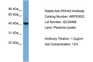 WB Suggested Anti-PDHA2  Antibody Titration: 0.
