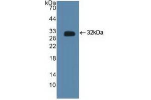 Western blot analysis of recombinant Human CTBP2. (CTBP2 抗体  (C-Term))
