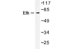 Image no. 1 for anti-BMX Non-Receptor Tyrosine Kinase (BMX) antibody (ABIN272021)